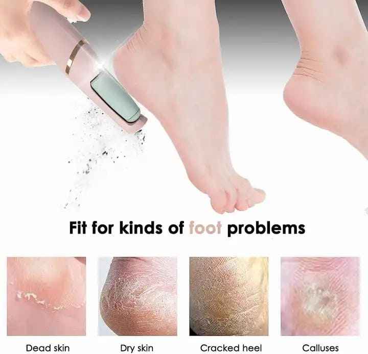 Electric Foot Callus Remover - Luxemir Store