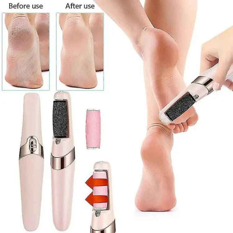 Electric Foot Callus Remover - Luxemir Store