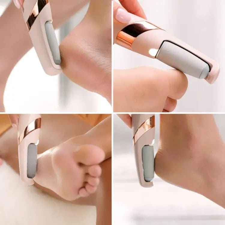 Electric Foot Callus Remover - Luxemir Store