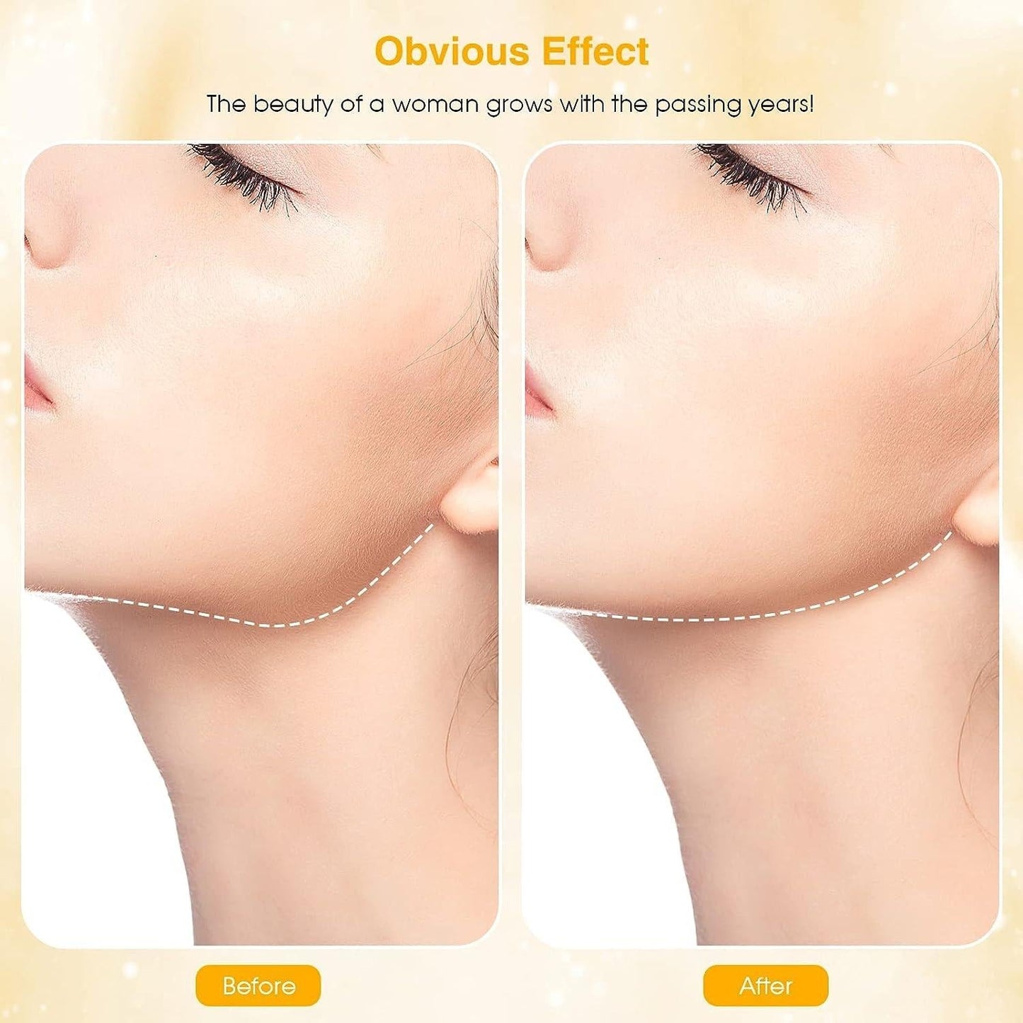 3 Colors Light Facial Lifting Tool Meifuly Face Device - Luxemir Store