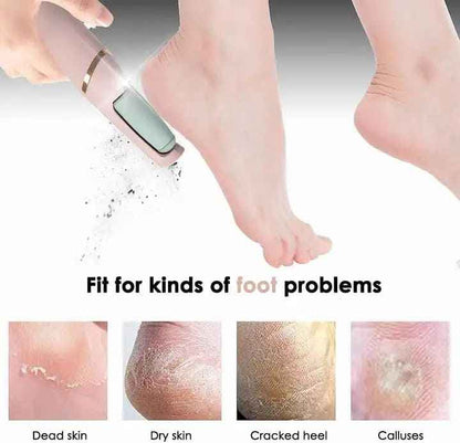 Electric Foot Callus Remover - Luxemir Store