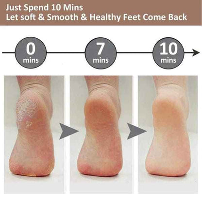 Electric Foot Callus Remover - Luxemir Store